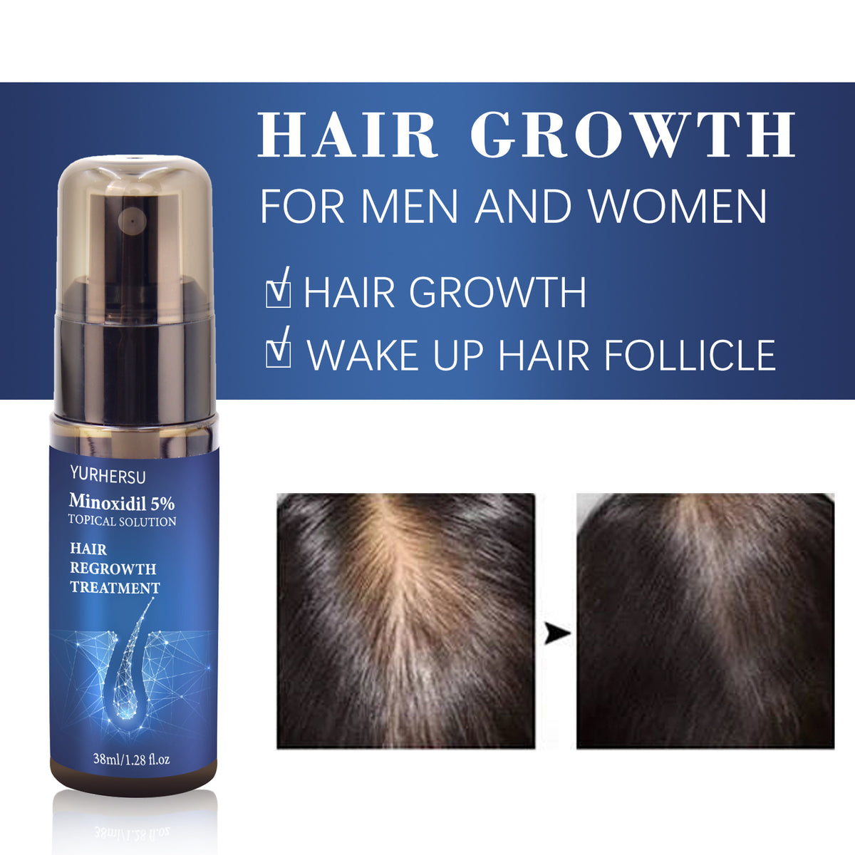 Minoxidil Hair Regrowth Serum