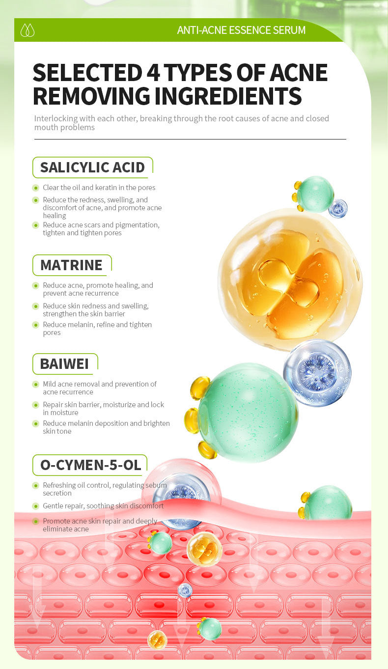 Salicylic Acid Anti-Acne & Pore Refining Serum (30ml)