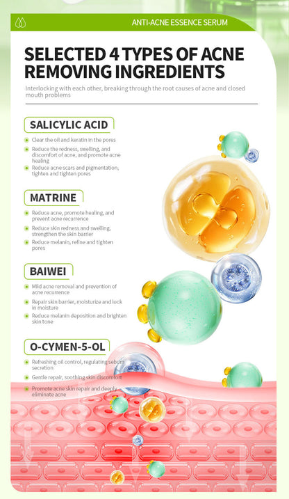 Salicylic Acid Anti-Acne & Pore Refining Serum (30ml)